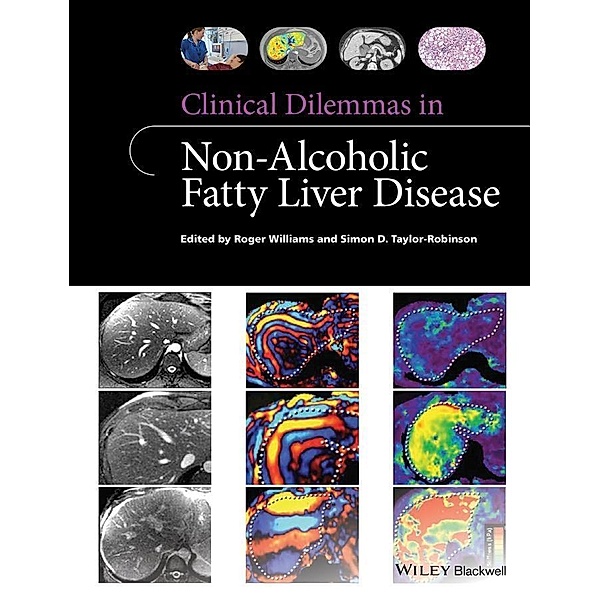 Clinical Dilemmas in Non-Alcoholic Fatty Liver Disease / Clinical Dilemmas, Roger Williams, Simon D. Taylor-Robinson