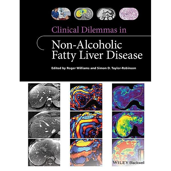 Clinical Dilemmas in Non-Alcoholic Fatty Liver Disease, Roger Williams, Simon D. Taylor-Robinson