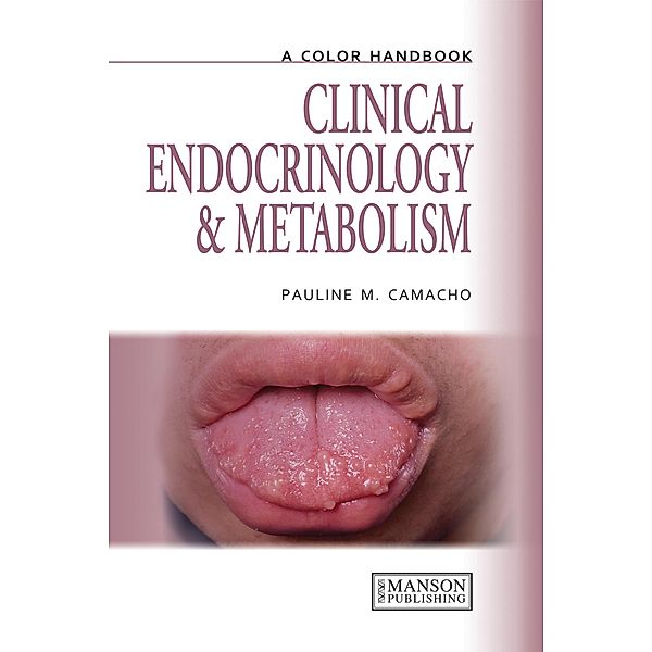 Clinical Endocrinology and Metabolism, Pauline Camacho