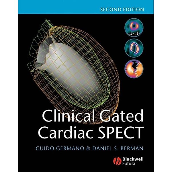 Clinical Gated Cardiac SPECT, Guido Germano, Daniel S. Berman