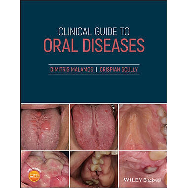 Clinical Guide to Oral Diseases, Dimitris Malamos, Crispian Scully