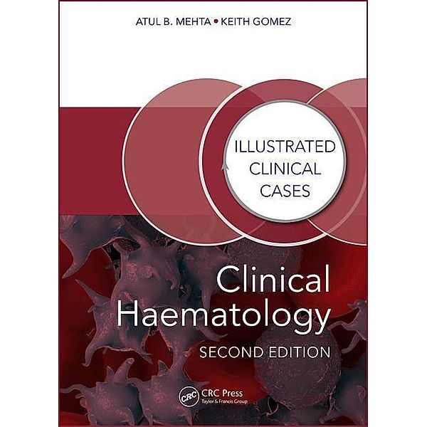 Clinical Haematology, Second Edition: Illustrated Clinical Cases, Atul Bhanu Mehta, Keith Gomez