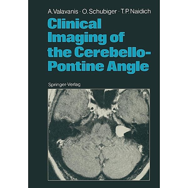 Clinical Imaging of the Cerebello-Pontine Angle, Anton Valavanis, Othmar Schubiger, Thomas P. Naidich