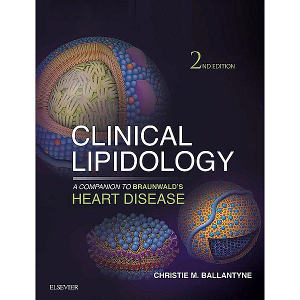 Clinical Lipidology: A Companion to Braunwald's Heart Disease E-Book / Companion to Braunwald's Heart Disease, Christie M. Ballantyne