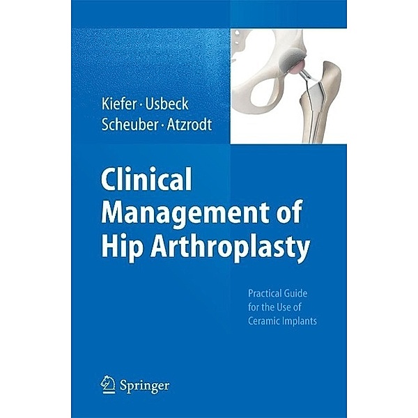 Clinical Management of Hip Arthroplasty, Hartmuth Kiefer