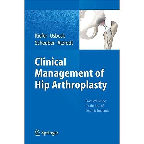 Clinical Management of Hip Arthroplasty, Hartmuth Kiefer