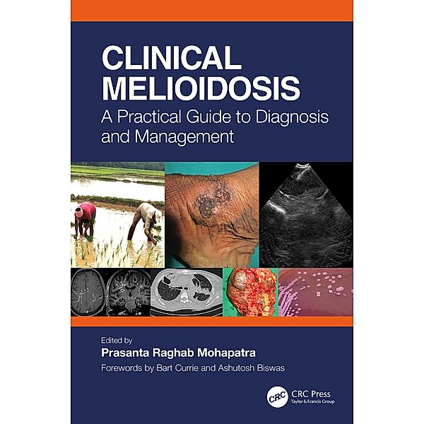 Clinical Melioidosis