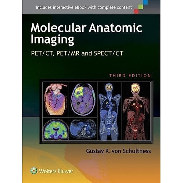 Clinical Molecular Anatomic Imaging, Gustav K. von Schulthess, Gustav K. von              10000485045 Schulthess