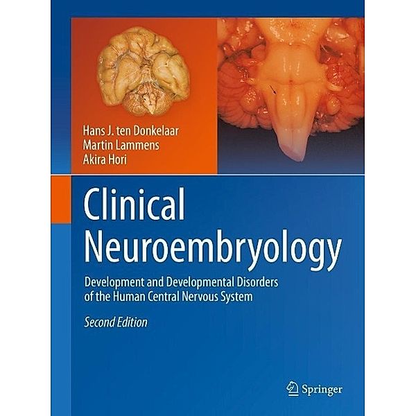 Clinical Neuroembryology, Hans J. ten Donkelaar, Martin Lammens, Akira Hori