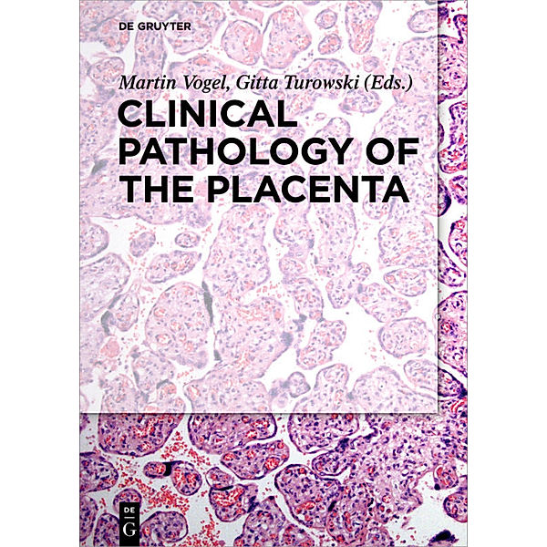 Clinical Pathology of the Placenta