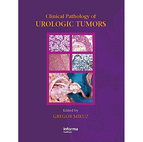 Clinical Pathology of Urological Tumours