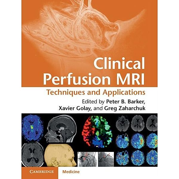 Clinical Perfusion MRI