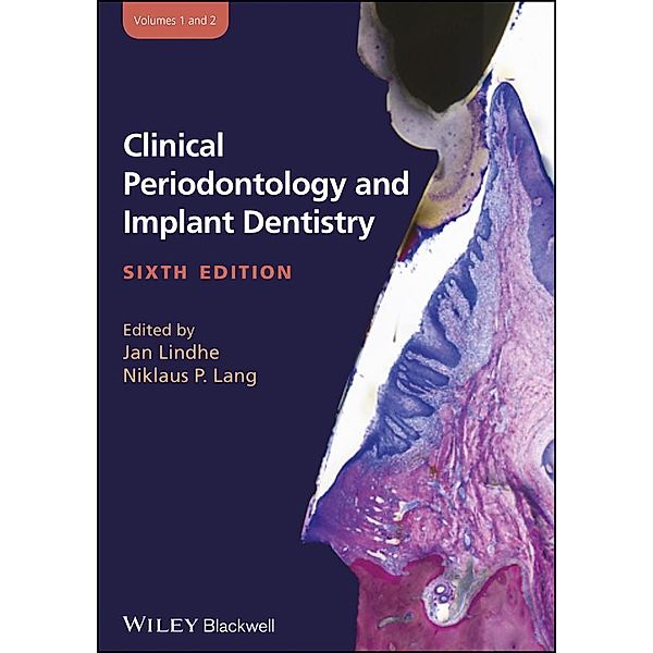 Clinical Periodontology and Implant Dentistry, 2 Volume Set