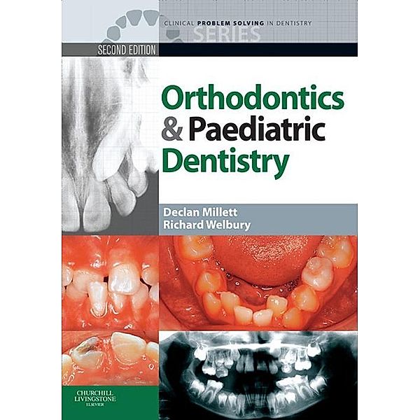 Clinical Problem Solving in Orthodontics and Paediatric Dentistry - E-Book, Declan Millett, Richard Welbury