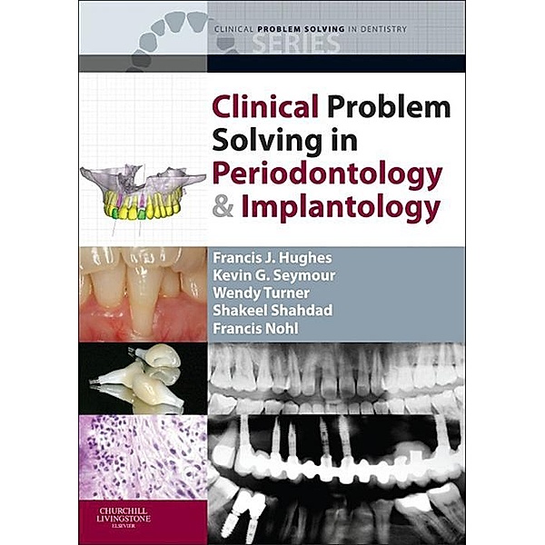 Clinical Problem Solving in Periodontology and Implantology - E-Book, Francis J. Hughes, Kevin G. Seymour, Wendy Turner, Shakeel Shahdad, Francis Nohl