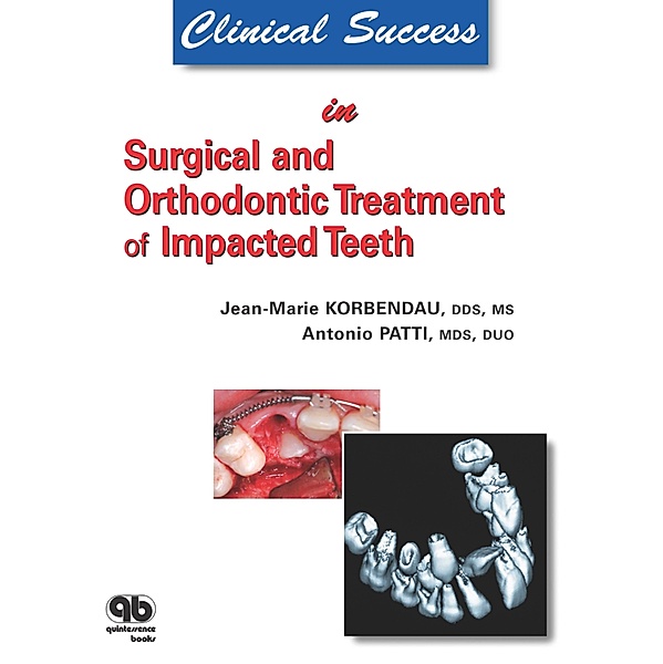 Clinical Success in Surgical and Orthodontic Treatment of Impacted Teeth, Jean-Marie Korbendau, Antonio Patti