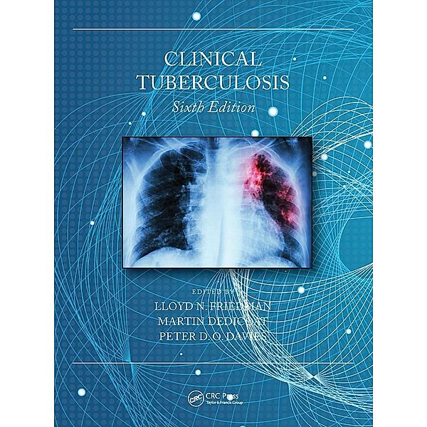 Clinical Tuberculosis