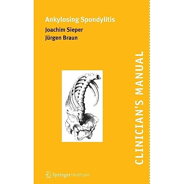 Clinician's Manual on Ankylosing Spondylitis, Joachim Sieper, Jürgen Braun