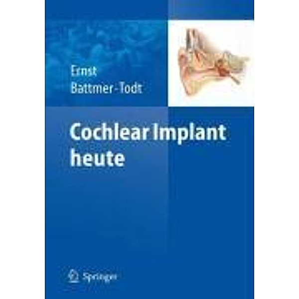 Cochlear Implant heute, Rolf-Dieter Battmer, Arneborg Ernst, Ingo Todt