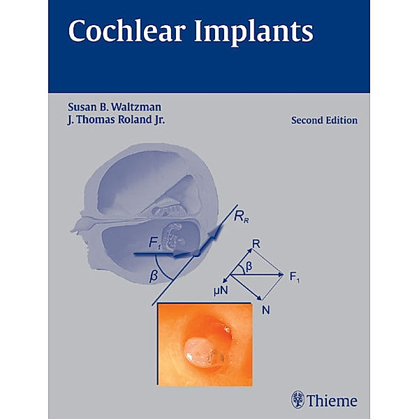 Cochlear Implants, Susan B. Waltzman, J. Thomas Roland