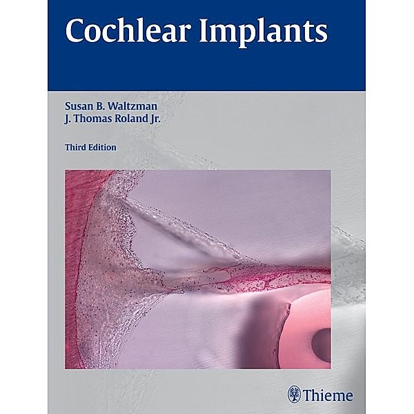 Cochlear Implants