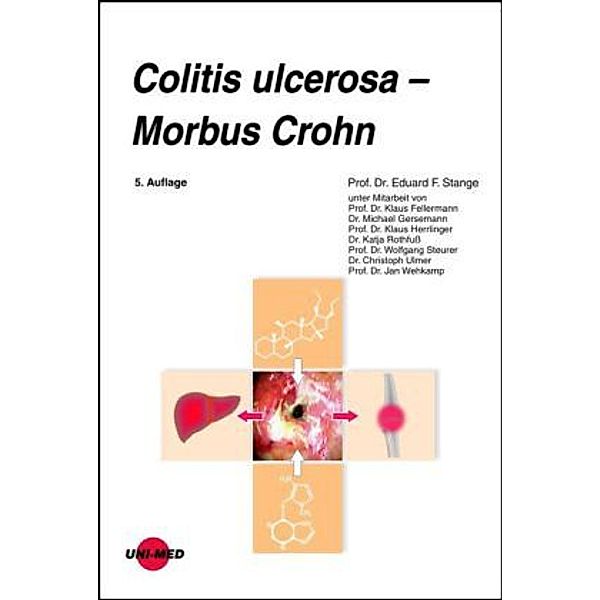 Colitis ulcerosa - Morbus Crohn, Eduard F. Stange