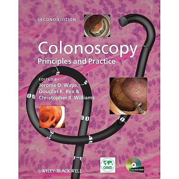 Colonoscopy