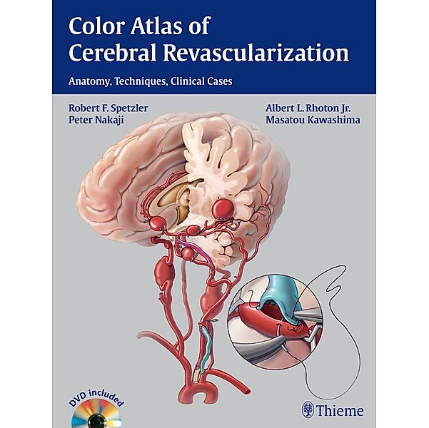 Color Atlas of Cerebral Revascularization, w. DVD, Robert F. Spetzler, Albert L. Rhoton, Peter Nakaji, Masatou Kawashima