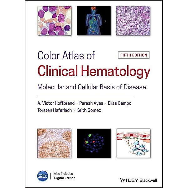 Color Atlas of Clinical Hematology, Victor Hoffbrand, Paresh Vyas, Elias Campo, Torsten Haferlach, Keith Gomez