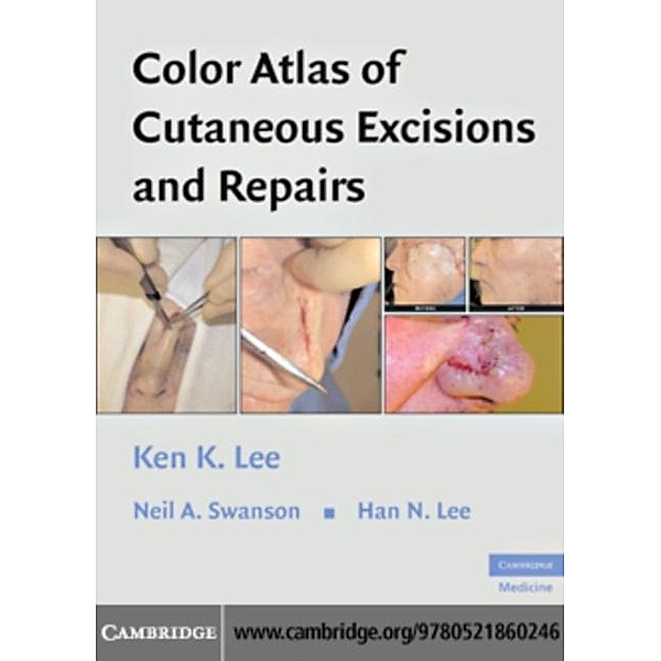 Color Atlas of Cutaneous Excisions and Repairs, Ken K. Lee