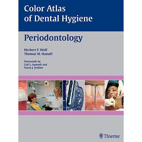Color Atlas of Dental Hygiene: Periodontology, Herbert F. Wolf, Thomas M. Hassell