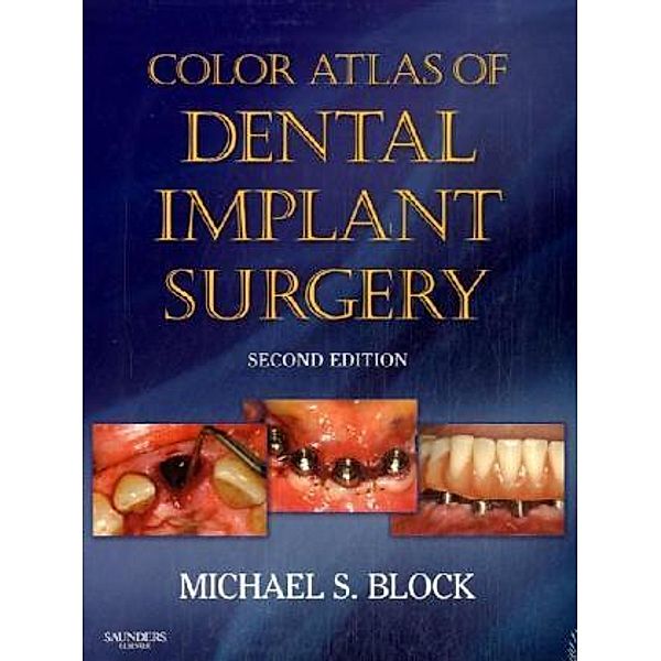 Color Atlas of Dental Implant Surgery, Michael S. Block