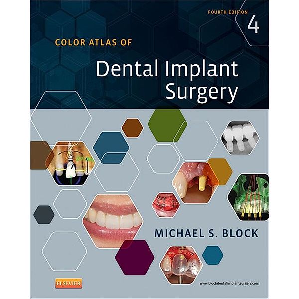 Color Atlas of Dental Implant Surgery - E-Book, Michael S. Block