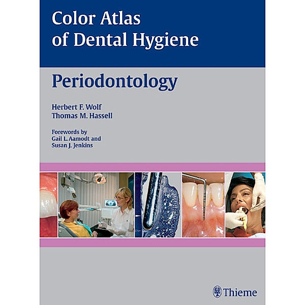 Color Atlas of Dental Medicine / Periodontology, Herbert F. Wolf, Thomas M. Hassel