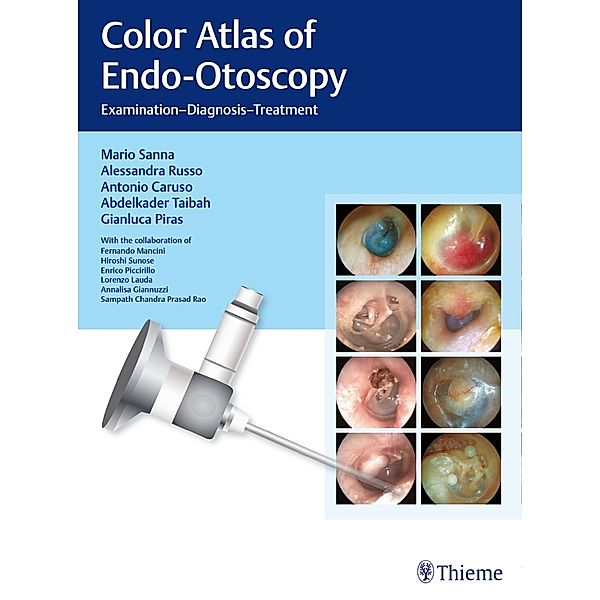 Color Atlas of Endo-Otoscopy, Mario Sanna