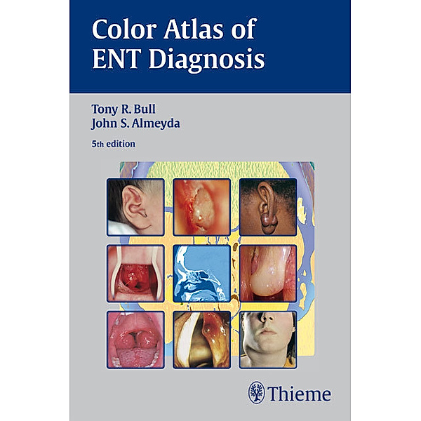 Color Atlas of ENT Diagnosis, Tony R. Bull, John S. Almeyda