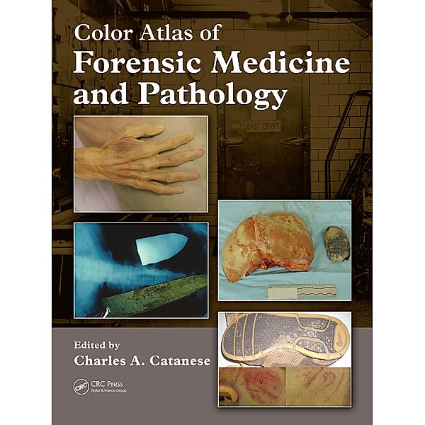 Color Atlas of Forensic Medicine and Pathology, Charles Catanese, Brian Heaton