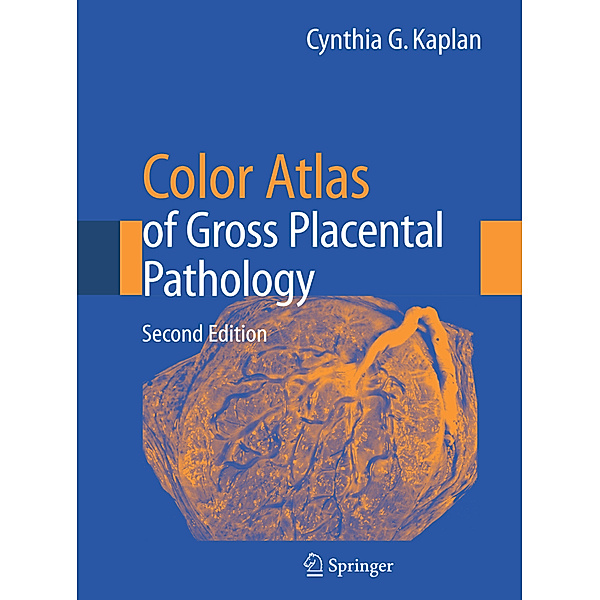 Color Atlas of Gross Placental Pathology, Cynthia G. Kaplan