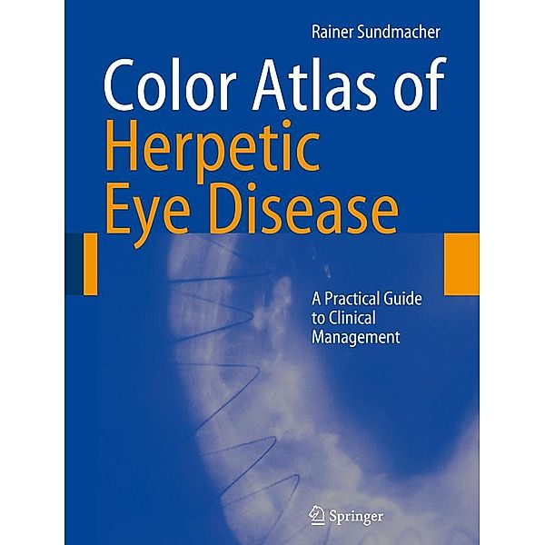 Color Atlas of Herpetic Eye Disease, Rainer Sundmacher