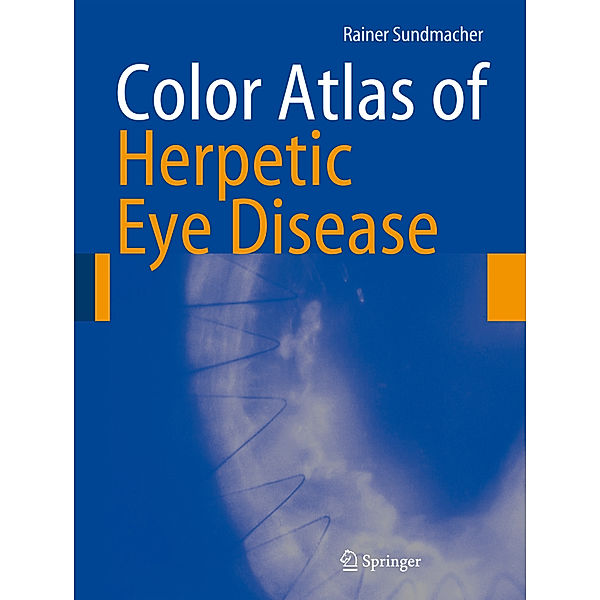 Color Atlas of Herpetic Eye Disease, Rainer Sundmacher