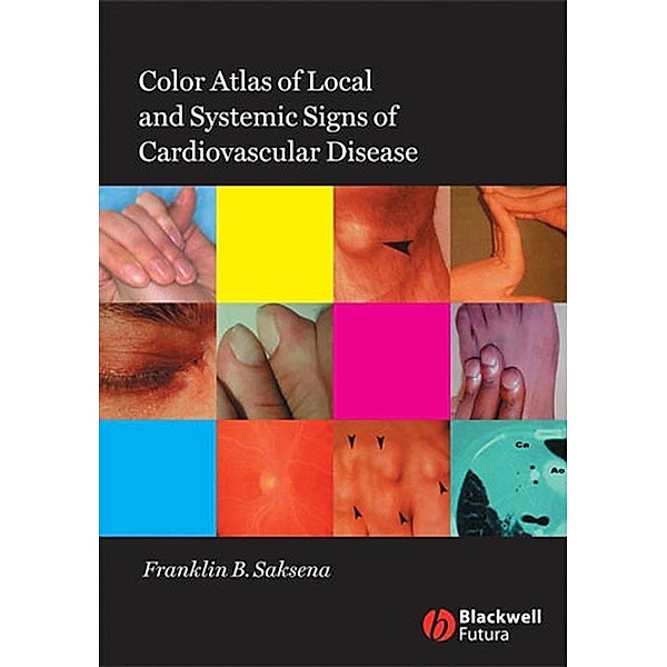Color Atlas of Local and Systemic Manifestations of Cardiovascular Disease, Franklin B. Saksena