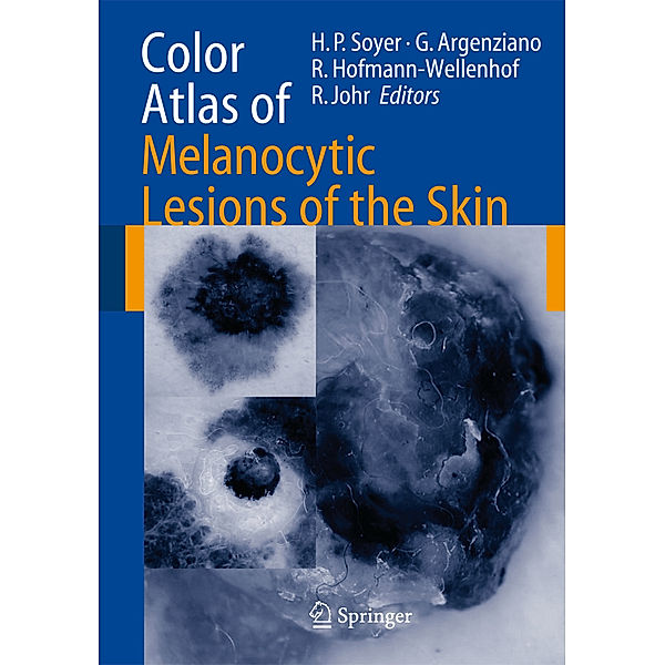 Color Atlas of Melanocytic Lesions of the Skin