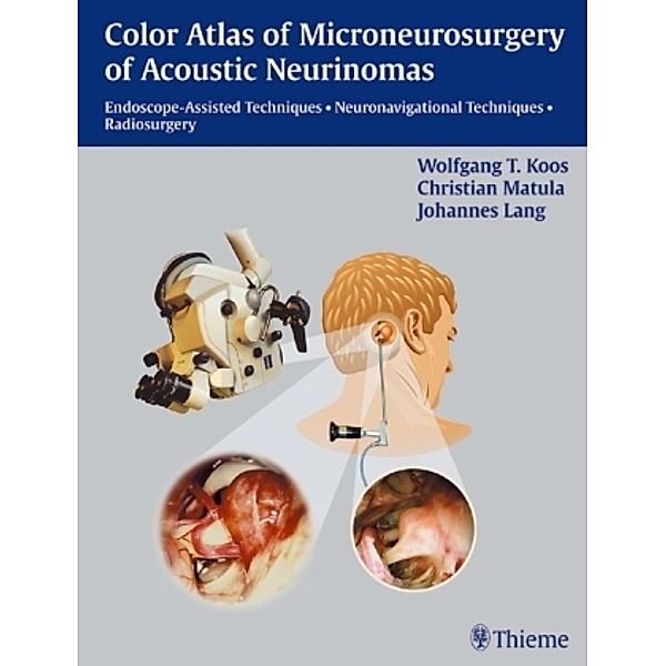 Color Atlas of Microneurosurgery of Acoustic Neurinomas, Wolfgang Th. Koos, Christian Mutala, Johannes Lang