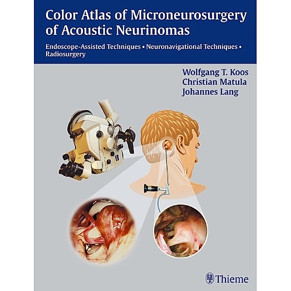 Color Atlas of Microsurgery of Acoustic Neurinomas, W. Koos, Christian Matula, Johannes Lang