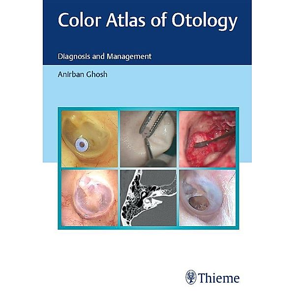 Color Atlas of Otology, Anirban Ghosh