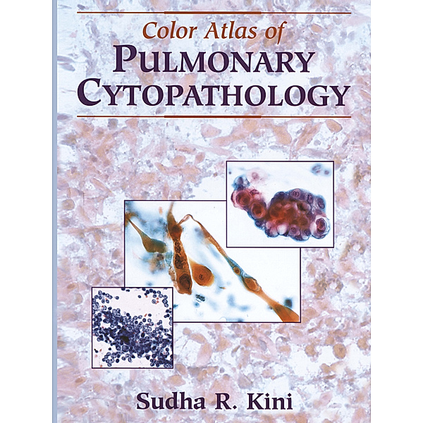 Color Atlas of Pulmonary Cytopathology, Sudha R. Kini