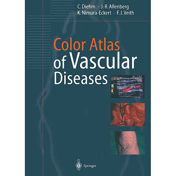Color Atlas of Vascular Diseases, C. Diehm, J.-R. Allenberg, K. Nimura-Eckert, F.J. Veith