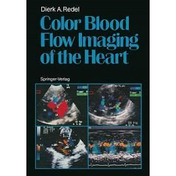 Color Blood Flow Imaging of the Heart, Dierk A. Redel
