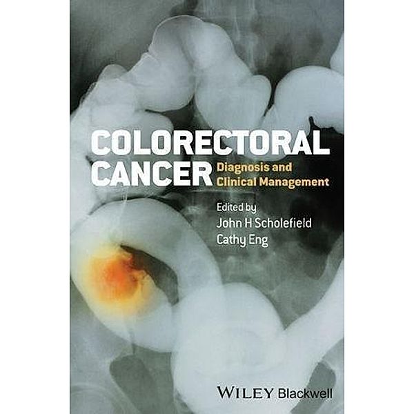 Colorectal Cancer