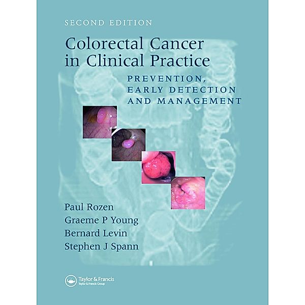 Colorectal Cancer in Clinical Practice